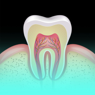 Dental root canal treatment